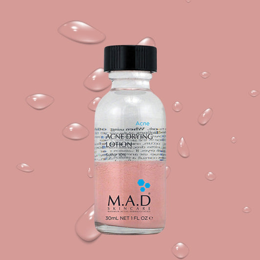 Acne Drying Lotion (30ML)